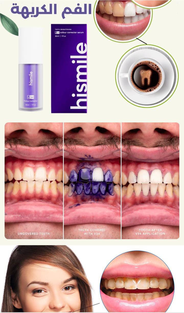 Hi Smile Teeth Cleaning Kit