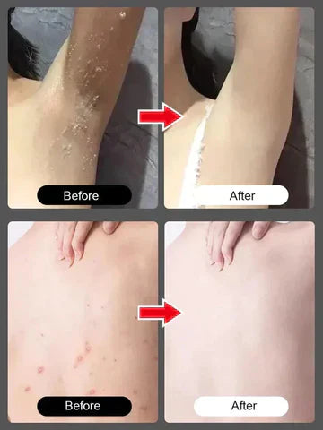 Bioaqua Peach Exfoliating Gel