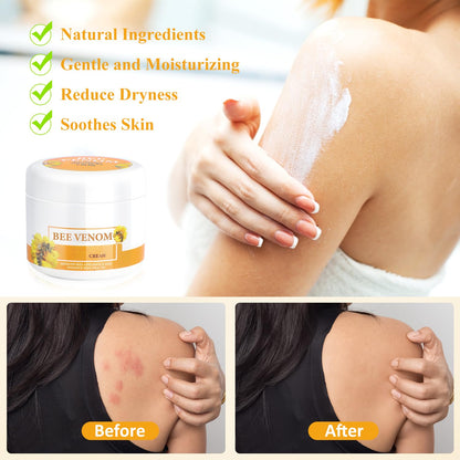 Bee Venam Wart & Mole Removel Cream