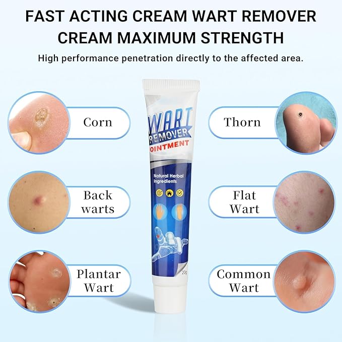 Wart Removal Cream